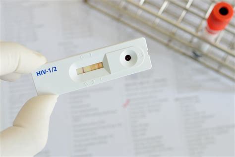 elisa kit hiv|elisa false negative.